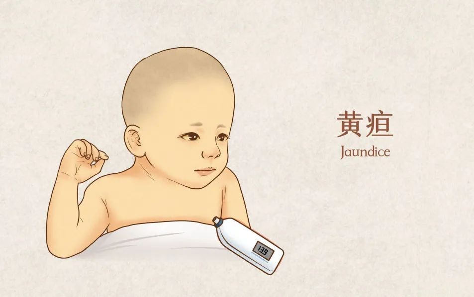 天津新世纪妇儿医院上线“新生儿黄疸光疗套餐” 关注宝宝健康成长
