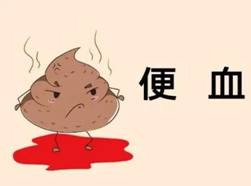 广州东大肛肠医院：以为是痔疮，却是大肠癌？简单小测试，分清是痔还是癌